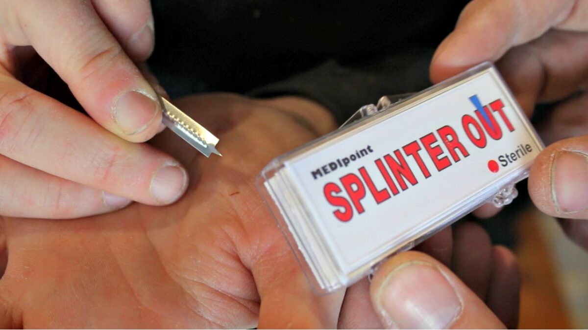 How To Get Splinter Out Easily At Home?
