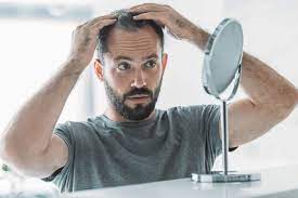 Things You Didn’t Know About Follicular Unit Extraction Hair Transplant In Dubai
