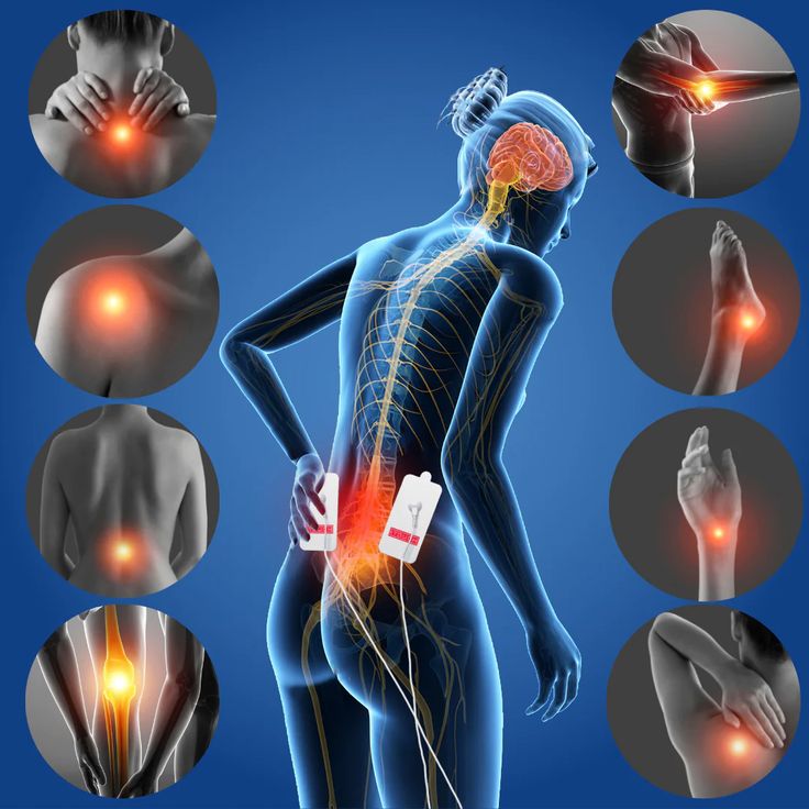 The Science of Chronic Pain: Exploring Mechanisms and Treatment Options